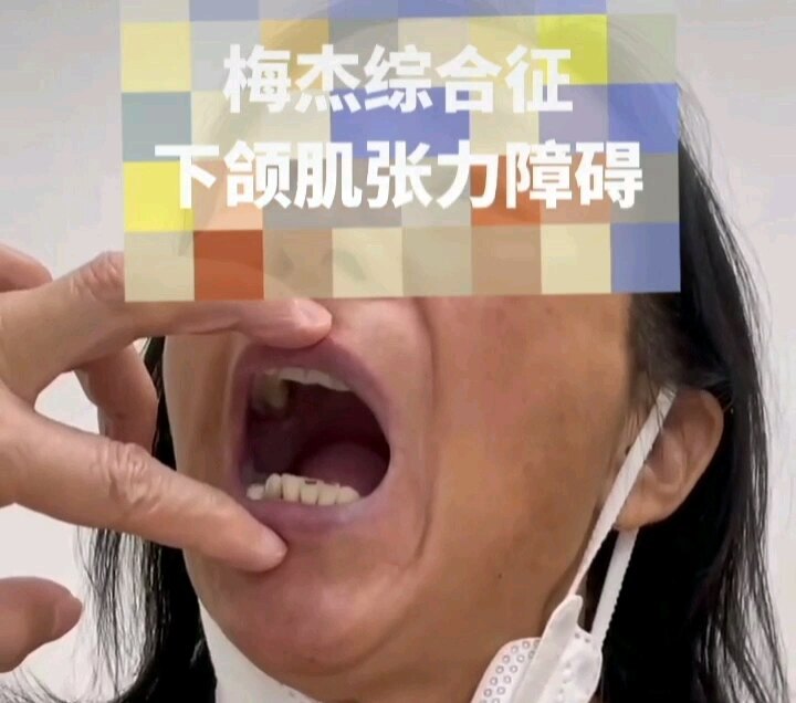 視頻封面