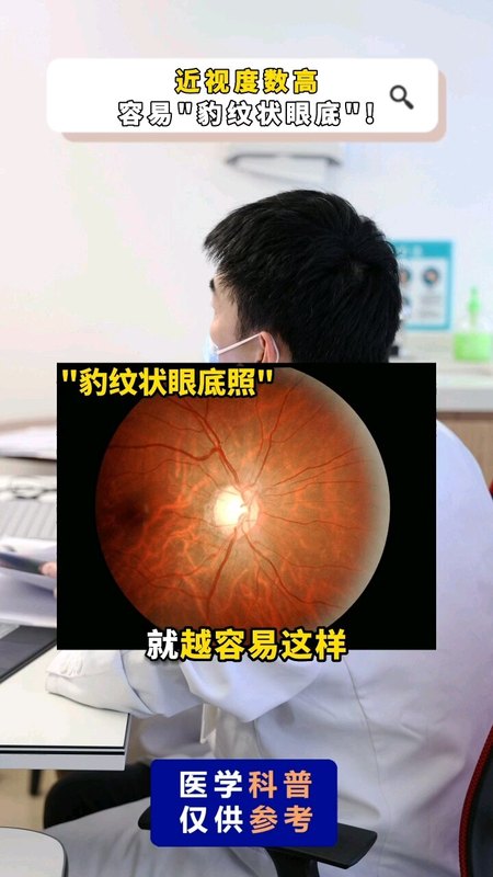 近视度数高，容易“豹纹状眼底”