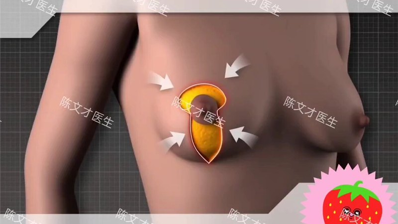 棒棒糖切口缩乳演视