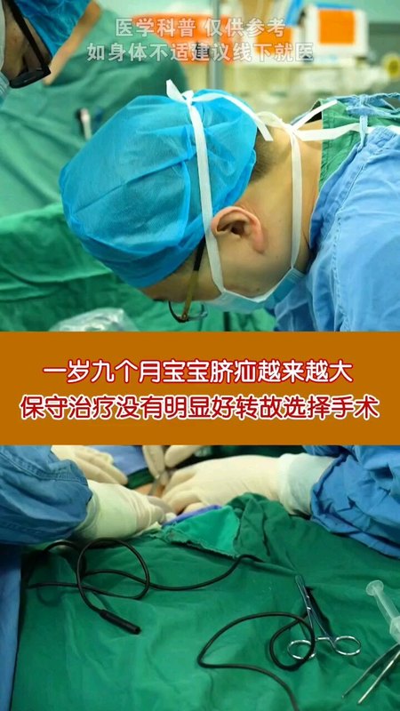一岁九个月宝宝脐疝越来越大，保守治疗没有明显好转故选择手术＃脐疝 ＃医学科普
