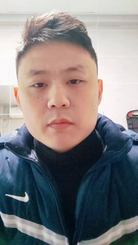 手汗症手术的痛：代偿转移性出汗