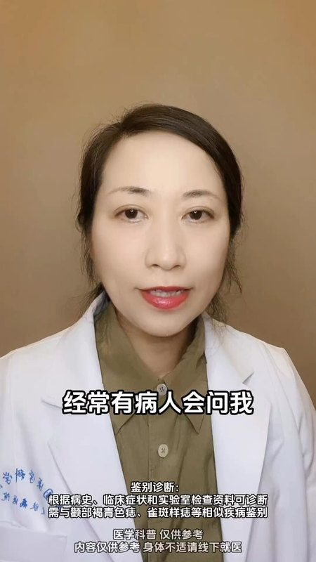 脸上雀斑怎么办？
