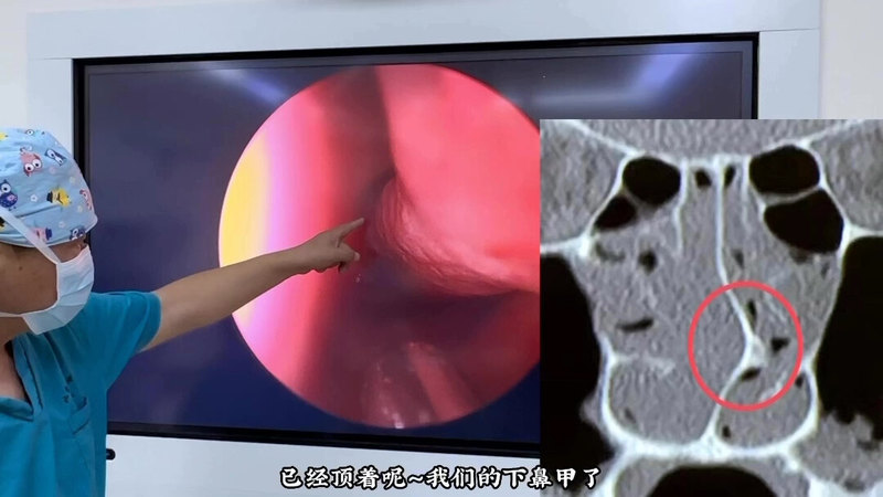 視頻封面