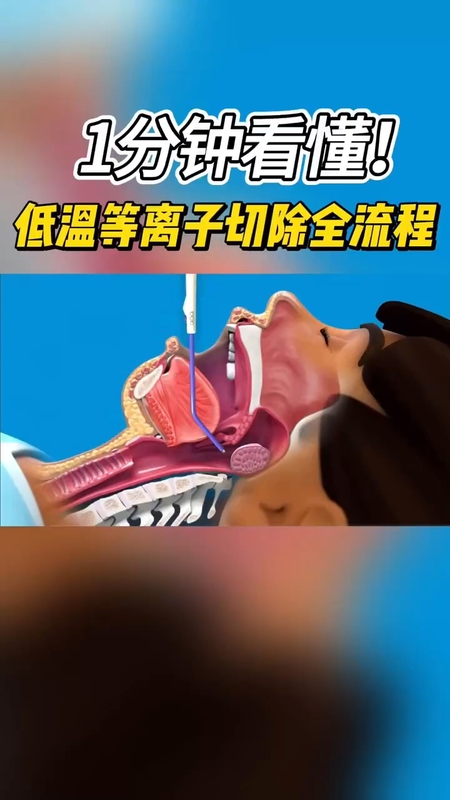 視頻封面