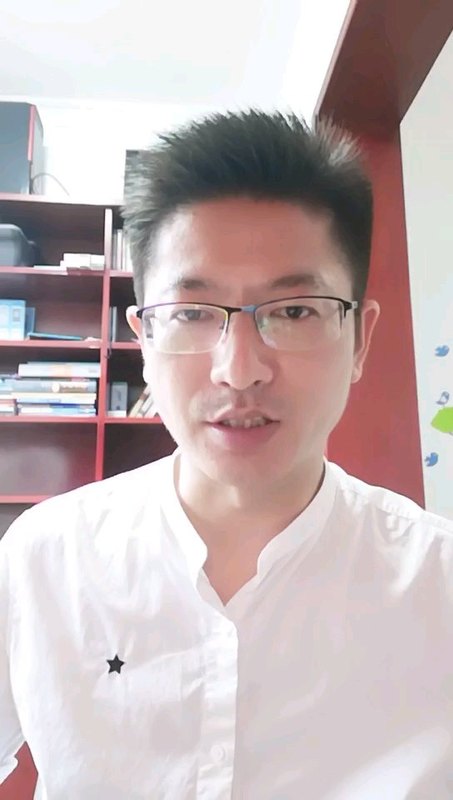 眼结石是长啥样？（眼结石又叫结膜结石，治疗：在表麻下裂隙灯显微镜下取出，门诊的一个小手术）。