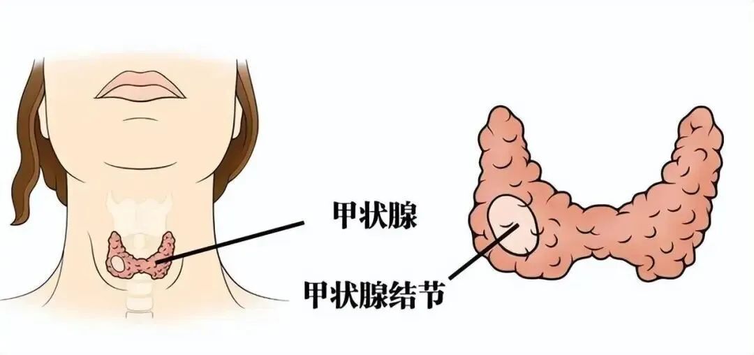 圖文圖片