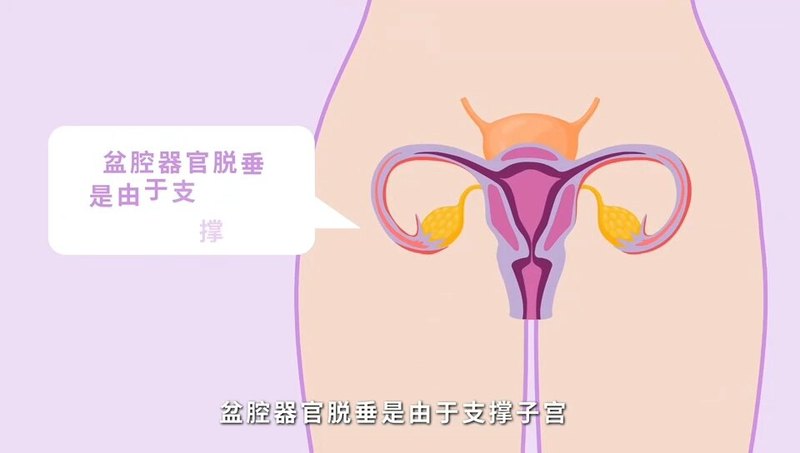 如何正确安放子宫托