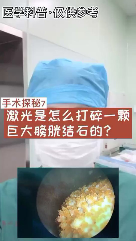 視頻封面