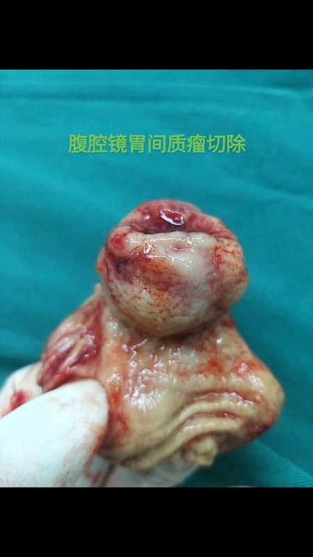 視頻封面