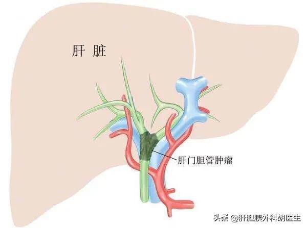 圖文圖片