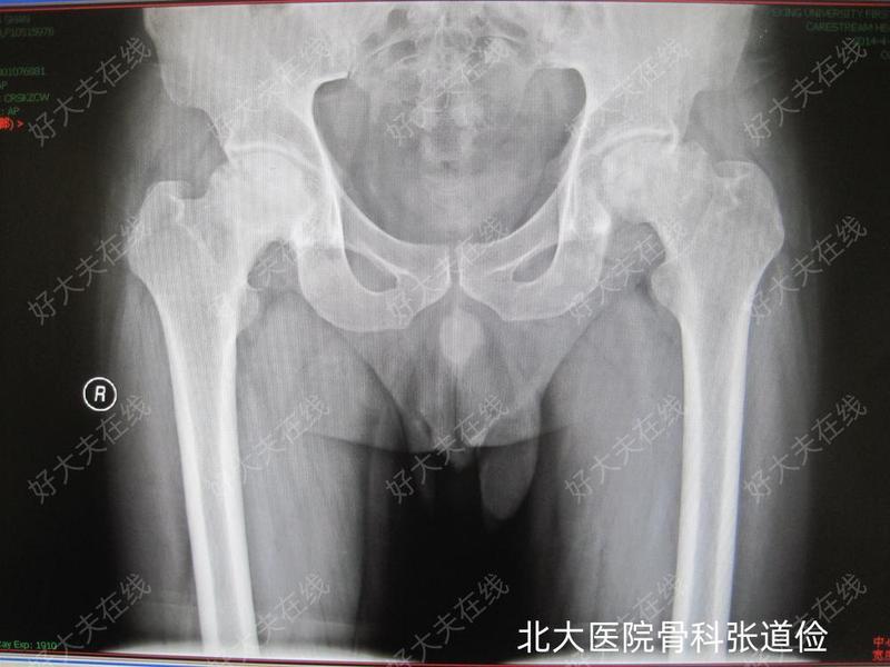 圖文圖片