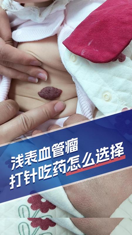 視頻封面