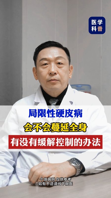 局限性硬皮病会不会蔓延全身？有没有快速的办法缓解控制！