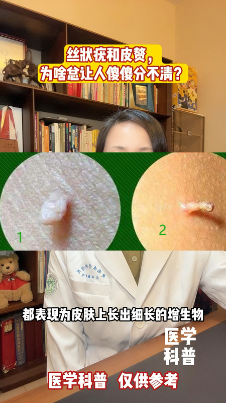 視頻封面