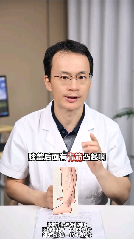 静脉曲张如何预防