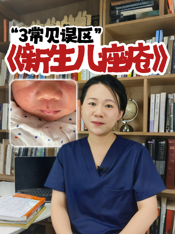 新生儿痤疮3个常见误区