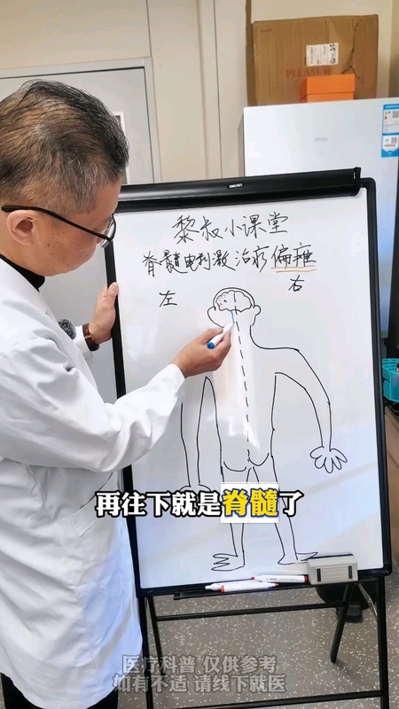脊髓电刺激治疗偏瘫的机制