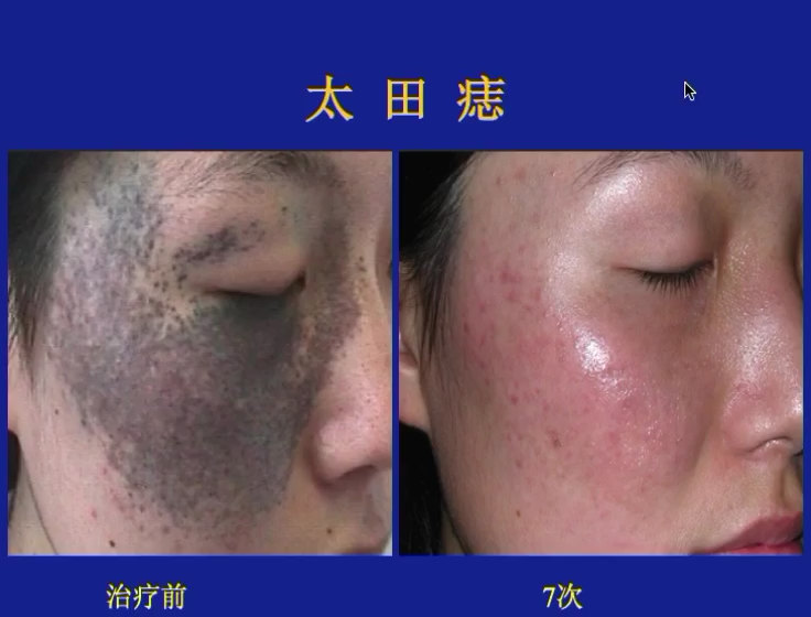 視頻封面