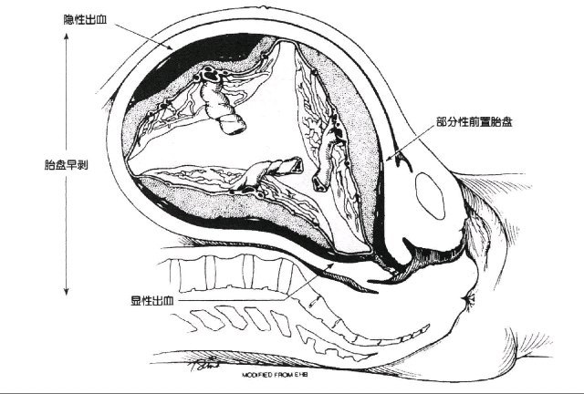 視頻封面