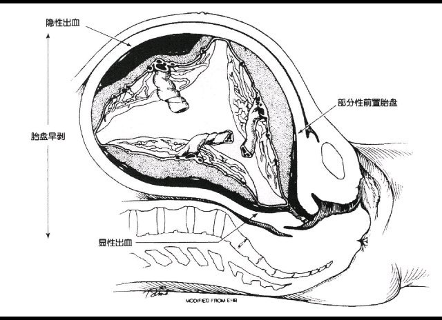 視頻封面