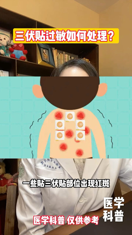 視頻封面