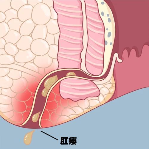 圖文圖片
