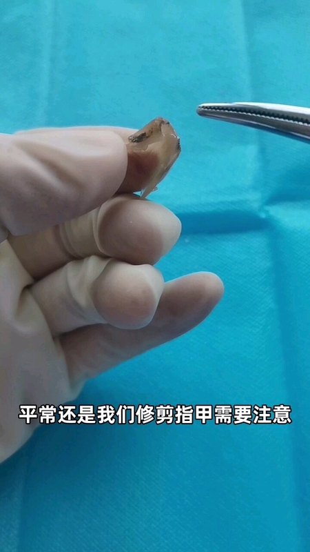 視頻封面