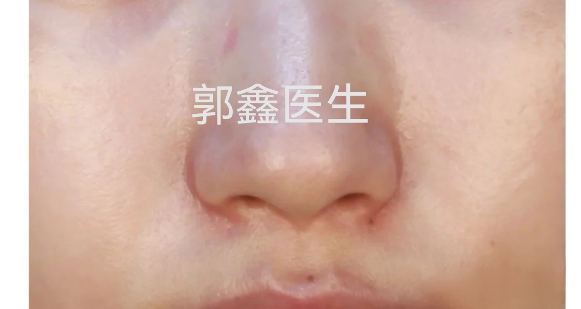 圖文圖片