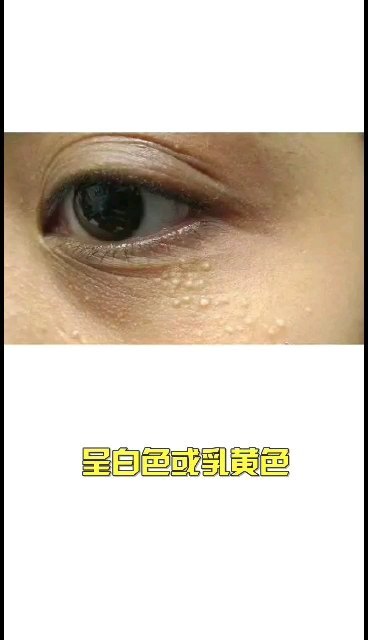 視頻封面