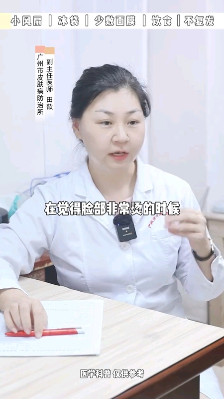 三个小习惯减轻玫瑰痤疮