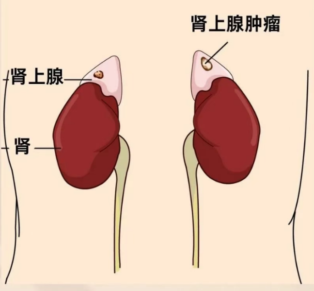 圖文圖片