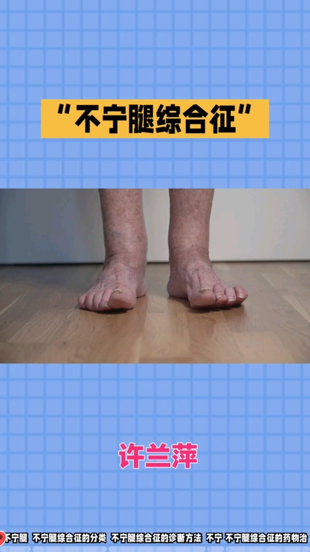 不宁腿综合征