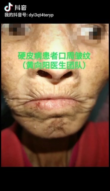 視頻封面