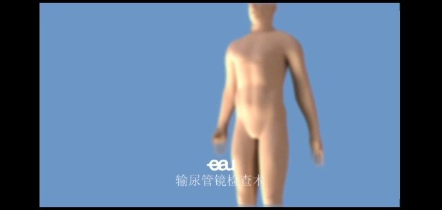 带你了解输尿管软镜检查取石术