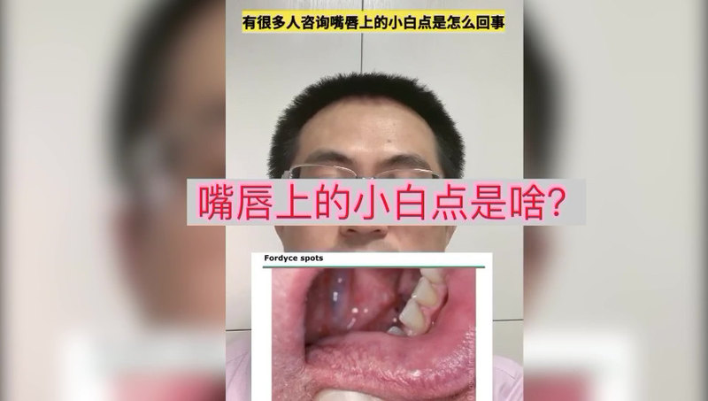 視頻封面