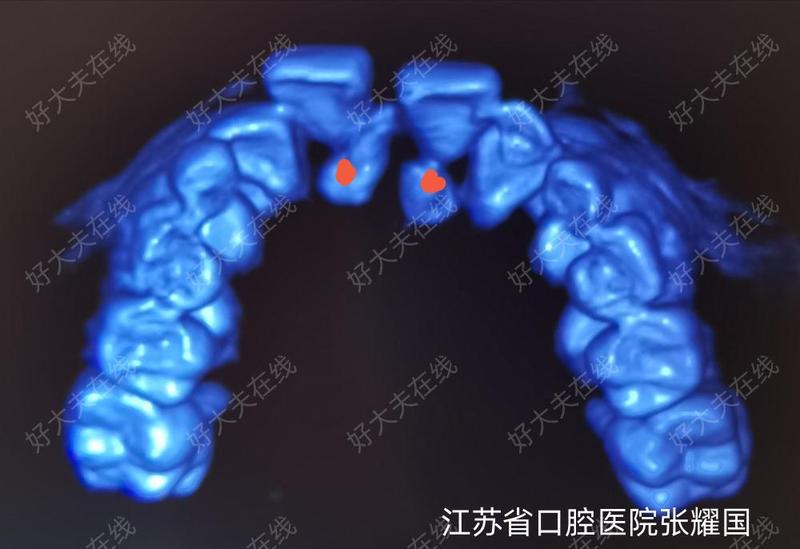 圖文圖片