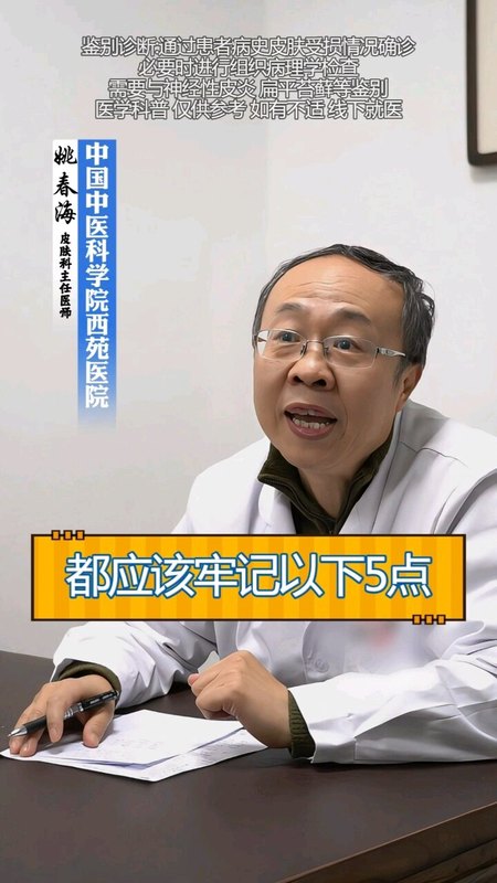 牛皮癣冬季注意事项分享