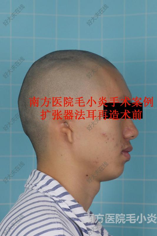 图文图片