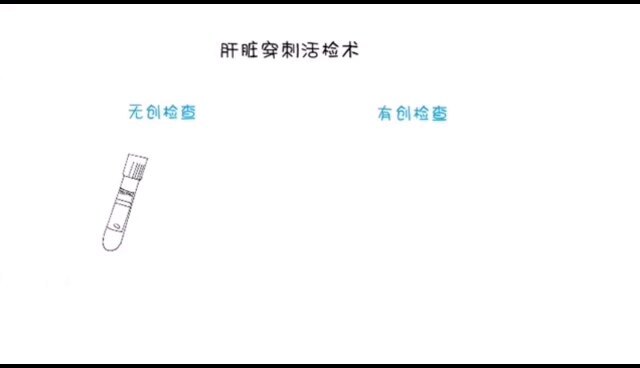 肝穿刺活检，其实没你想象的那么可怕！