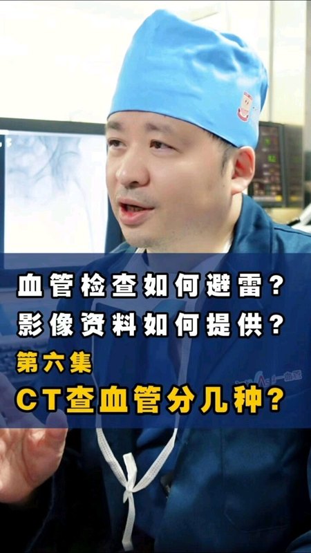 查血管的CT分哪几种？