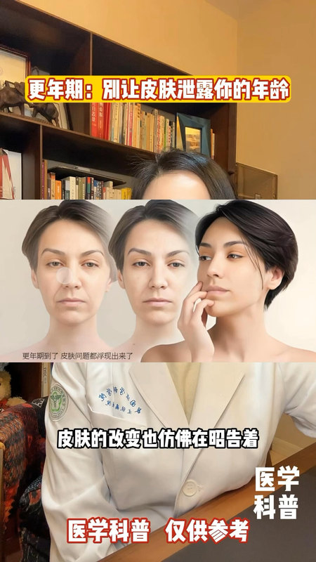 更年期，别让皮肤泄露了你的年龄