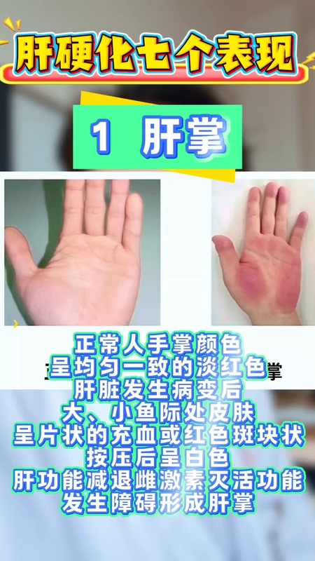 視頻封面