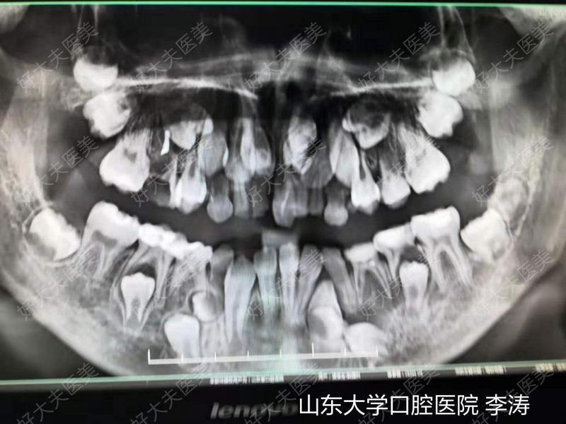 圖文圖片