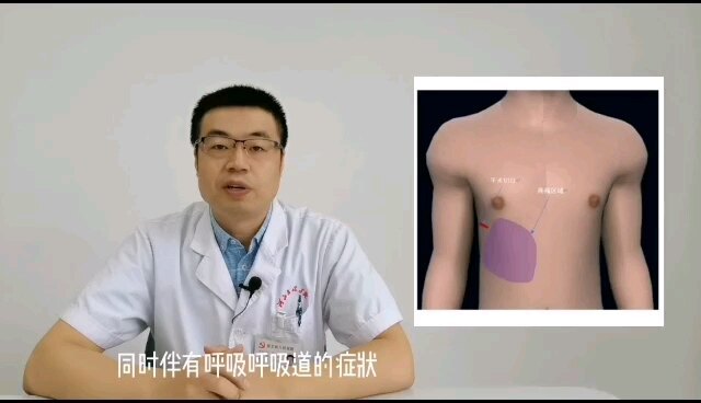 胸腔镜术后胸壁疼痛