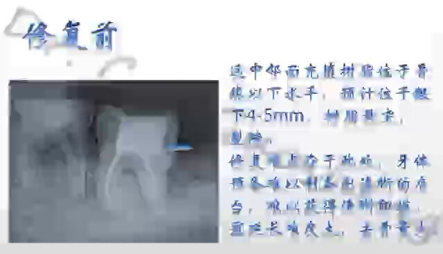 視頻封面