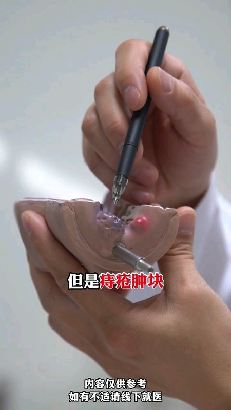 自行初步判断患了痔疮还是肛周脓肿。