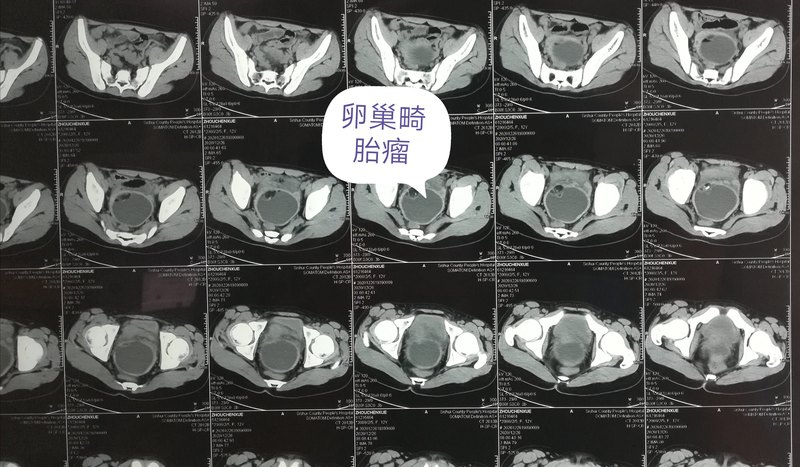 圖片