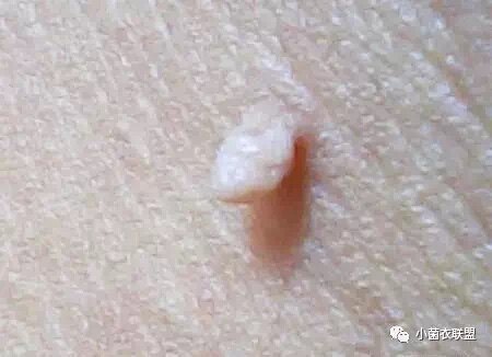 圖文圖片