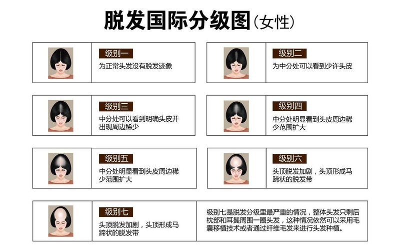 圖文圖片