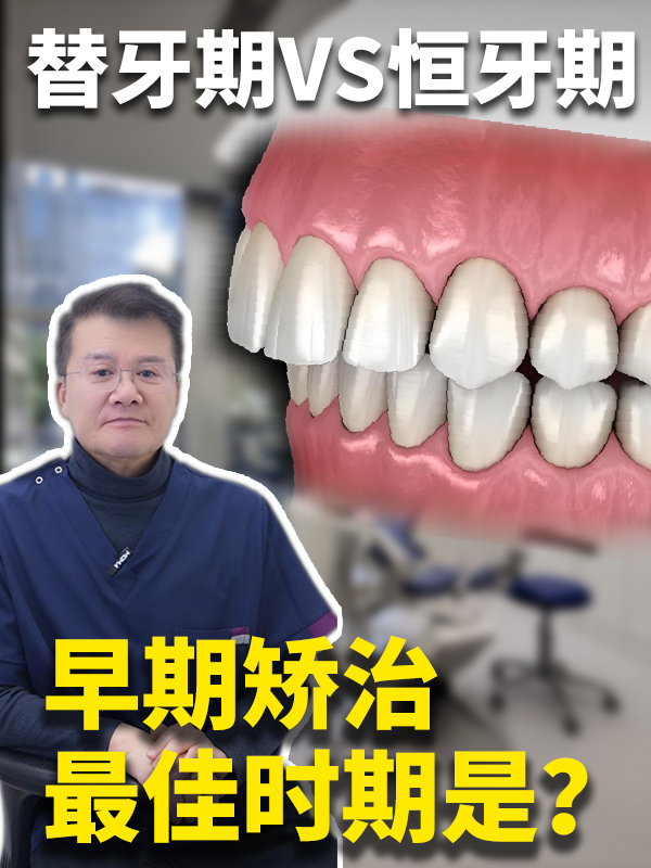 替牙期VS恒牙期 早期矫治的最佳时间